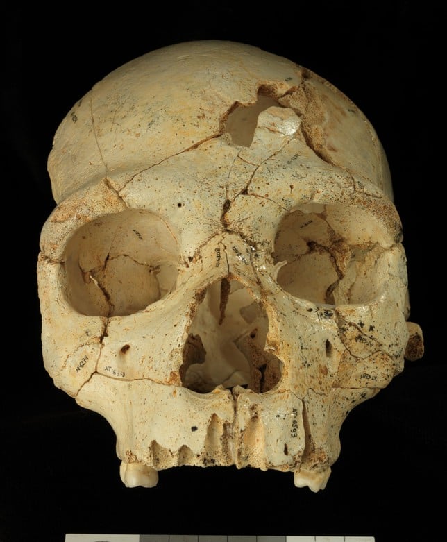 Cráneo del primer homicidio de la historia. Foto Fundación Atapuerca, España.